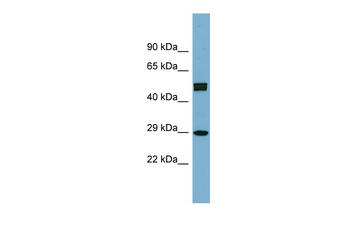 HOXC8 Rabbit Polyclonal Antibody