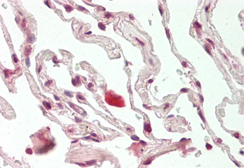 PROX1 Rabbit Polyclonal Antibody