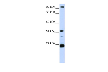 SNF8 Rabbit Polyclonal Antibody