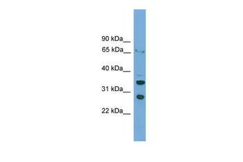 DBP Rabbit Polyclonal Antibody