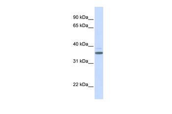 DBP Rabbit Polyclonal Antibody