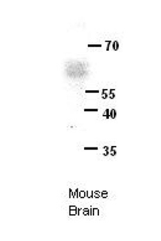 ERG Rabbit Polyclonal Antibody