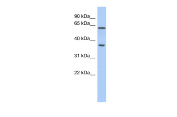 ERG Rabbit Polyclonal Antibody