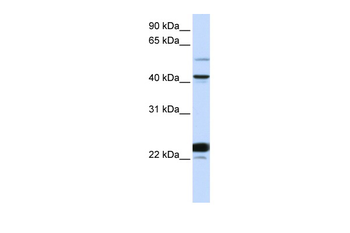 EVX1 Rabbit Polyclonal Antibody