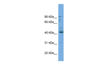 HOXB3 Rabbit Polyclonal Antibody