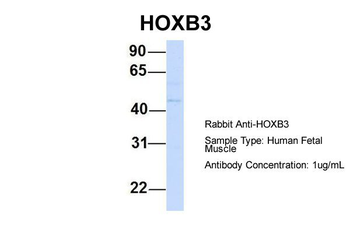 HOXB3 Rabbit Polyclonal Antibody