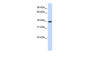HOXB3 Rabbit Polyclonal Antibody
