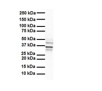HOXB3 Rabbit Polyclonal Antibody