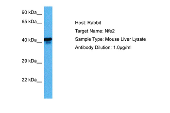 NFE2 Rabbit Polyclonal Antibody