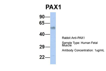 PAX1 Rabbit Polyclonal Antibody