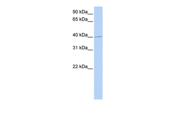 PAX1 Rabbit Polyclonal Antibody