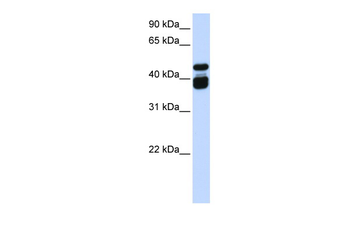 TBX6 Rabbit Polyclonal Antibody