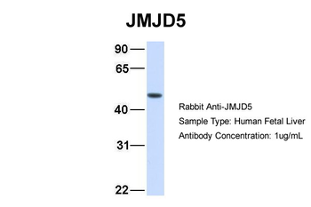 JMJD5 Rabbit Polyclonal Antibody