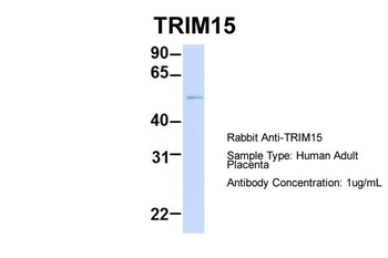 TRIM15 Rabbit Polyclonal Antibody