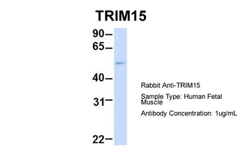 TRIM15 Rabbit Polyclonal Antibody