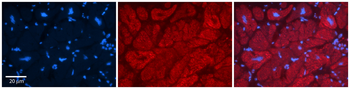 TRIM15 Rabbit Polyclonal Antibody