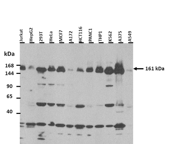 MED14 Rabbit Polyclonal Antibody