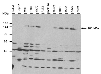MED14 Rabbit Polyclonal Antibody