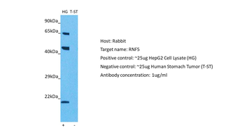 RNF5 Rabbit Polyclonal Antibody
