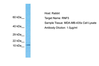 RNF5 Rabbit Polyclonal Antibody
