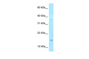 PHLDA2 Rabbit Polyclonal Antibody