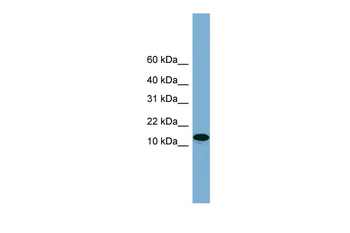 H2AFX Rabbit Polyclonal Antibody