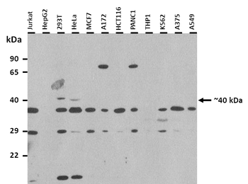 H2AFY Rabbit Polyclonal Antibody