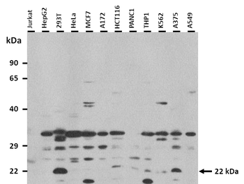HIST1H1E Rabbit Polyclonal Antibody