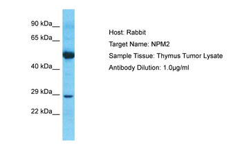 NPM2 Rabbit Polyclonal Antibody