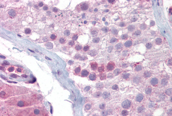 SYCP3 Rabbit Polyclonal Antibody