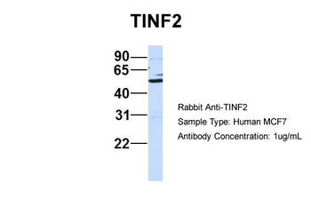 TINF2 Rabbit Polyclonal Antibody