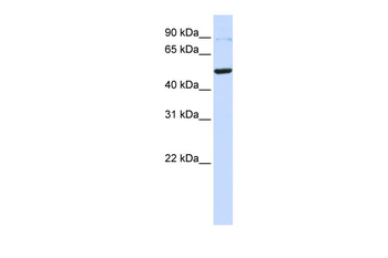 TINF2 Rabbit Polyclonal Antibody