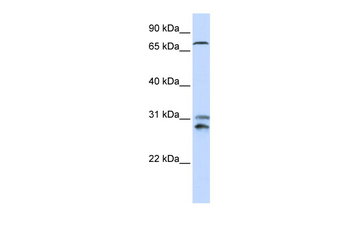 TLK2 Rabbit Polyclonal Antibody