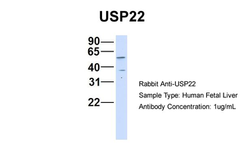USP22 Rabbit Polyclonal Antibody
