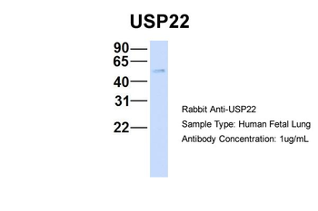USP22 Rabbit Polyclonal Antibody