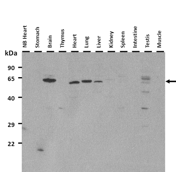 Usp27x Rabbit Polyclonal Antibody