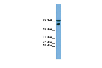 ZNF765 Rabbit Polyclonal Antibody