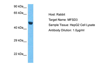 MFSD3 Rabbit Polyclonal Antibody