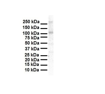 EVI1 Rabbit Polyclonal Antibody