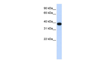 CDC2 Rabbit Polyclonal Antibody