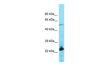 ACOT4 Rabbit Polyclonal Antibody