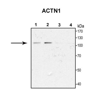 ACTN1 Rabbit Polyclonal Antibody
