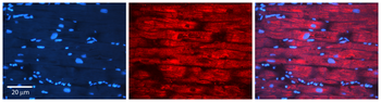 APRT Rabbit Polyclonal Antibody