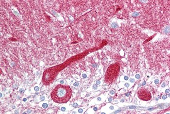 CPE Rabbit Polyclonal Antibody