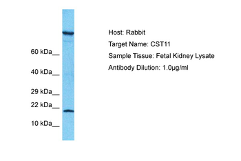CST11 Rabbit Polyclonal Antibody