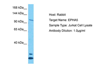 EPHA5 Rabbit Polyclonal Antibody
