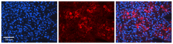 GRB2 Rabbit Polyclonal Antibody