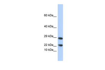 LCN8 Rabbit Polyclonal Antibody