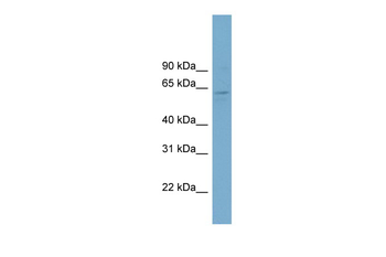 MINDY4B Rabbit Polyclonal Antibody