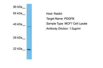 PDGFB Rabbit Polyclonal Antibody